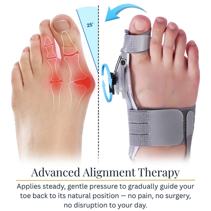 Halluxa™ - Correct Your Bunion Without Surgery